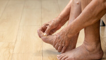 image of an elderly woman massaging her foot due to swelling